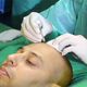 Illustration for article titled Hair Transplant in Rawalpindi/Islamabad